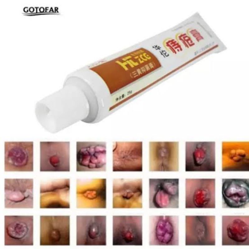 SALEP AMBEIEN, AMBIEN, AMBEIEN / WASIR