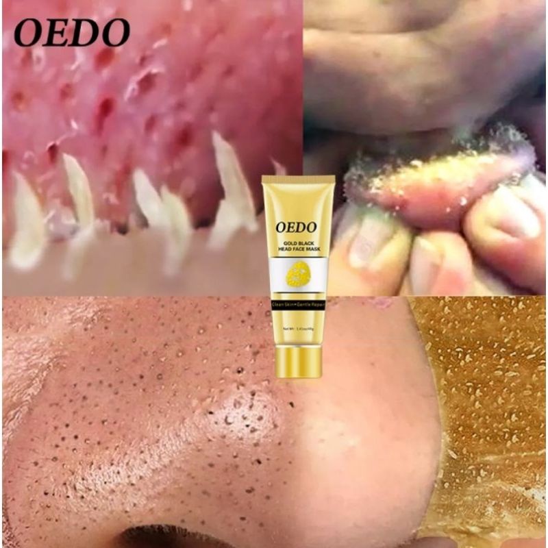 OEDO GOLD REMOVED BLACKHEAD MASKER SHRINK PORE IMPROVE ROUGH SKIN ACNE SHILLS BLACKHEAD REMOVER MASK