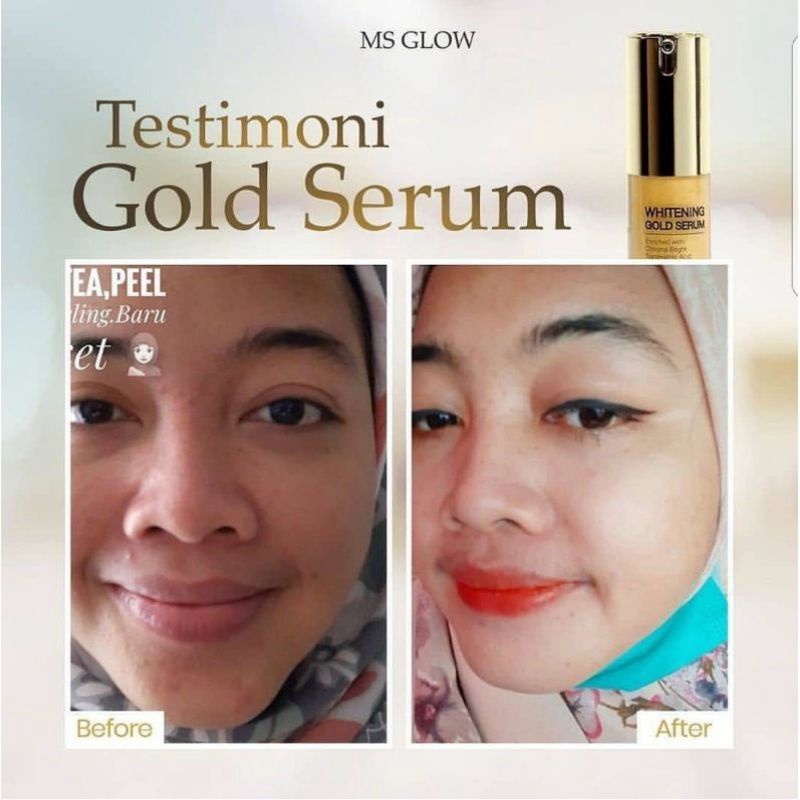 SERUM WHITENING GOLD ORIGINAL MS GLOW (SUDAH BER BARCODE TERBARU)