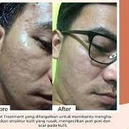 MS GLOW FOR MEN ORIGINAL PAKET WAJAH PRIA LENGKAP | PAKET MS GLOW FOR MEN