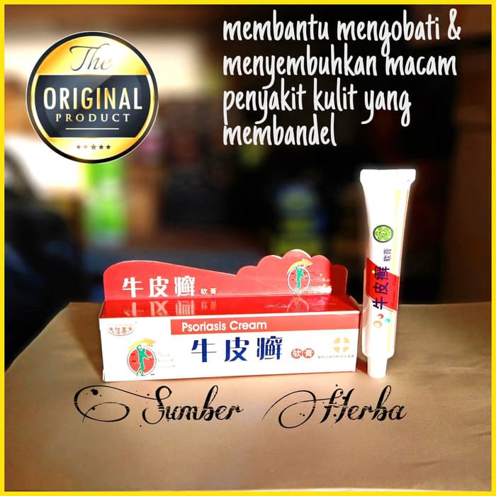 Salep Cina PSORIASIS | Cream Ampuh Mengobati Exim Dll.