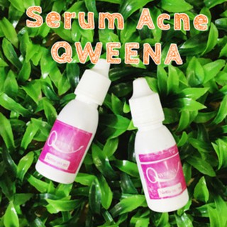 Qweena Serum Acne Obat Jerawat Shopee Indonesia