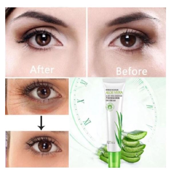 Aloevera Eye Lift Gel Penghilang Kerutan Kantung Mata Panda Keriput 20g