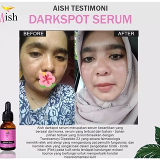 ✨ AKU MURAH ✨ AISH Serum KOREA Series BPOM