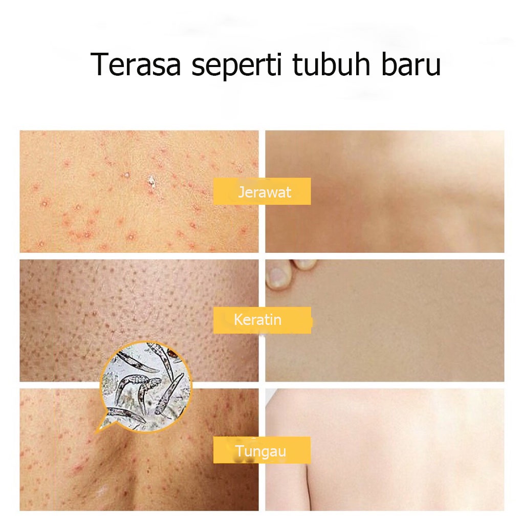 Sabun Mandi Cair Anti-Tungau  Melembabkan Kulit  Body Wash 260g Membersihkan Pori-Pori Dan Kotoran  Mengcagah Munculnya Jerawat  Efek Pelembab Yg Jelas