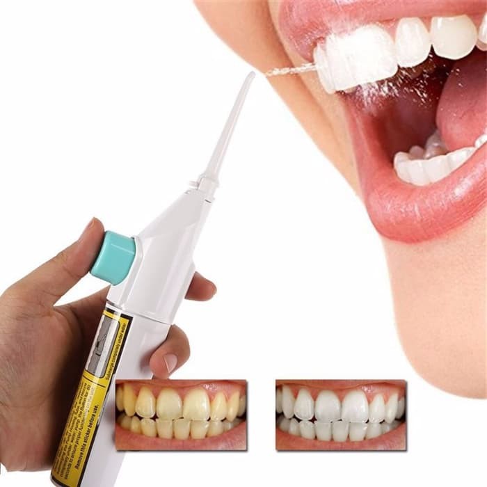 Portable Power Floss Dental Jet - Alat Pembersih Karang Gigi