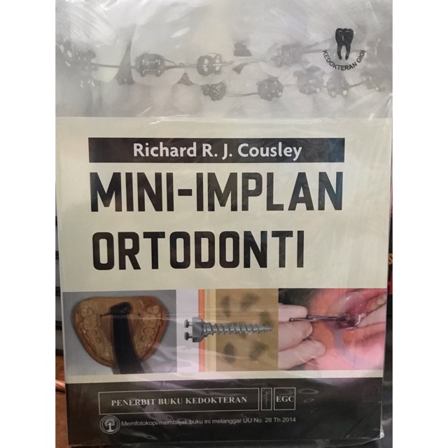 Mini - implan ortodonti