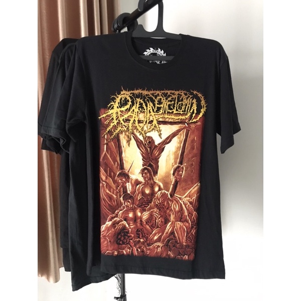 Kaos Band Radang Kelamin