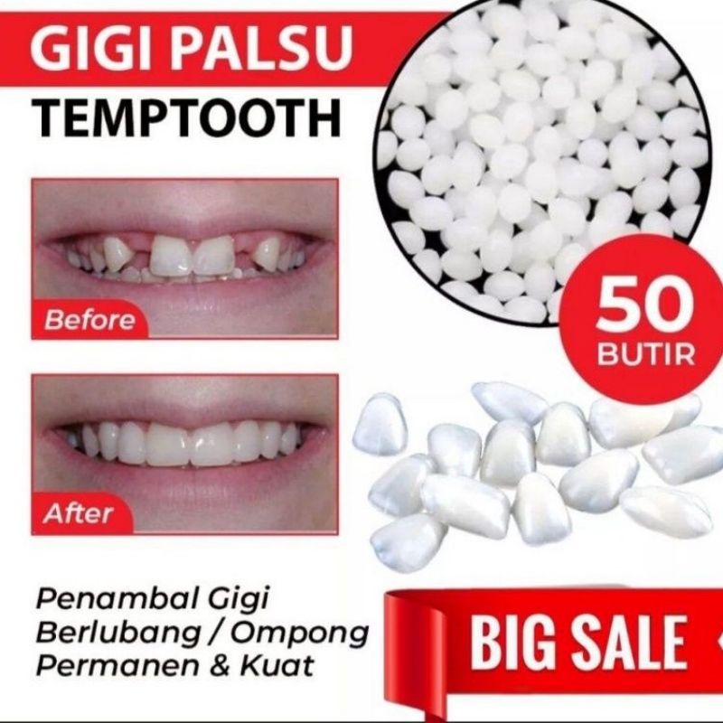 [50 Butir] Penambal Gigi Berlubang Temptooth Gigi Palsu Atas Bawah Penutup Gigi Berlubang