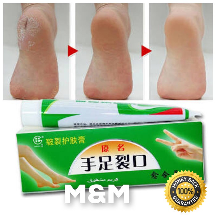 Salep Kaki Pecah / Obat Kaki Salep Obat Tumit Kaki Pecah Pecah / Salep Kaki Pecah / Obat Kaki Pecah