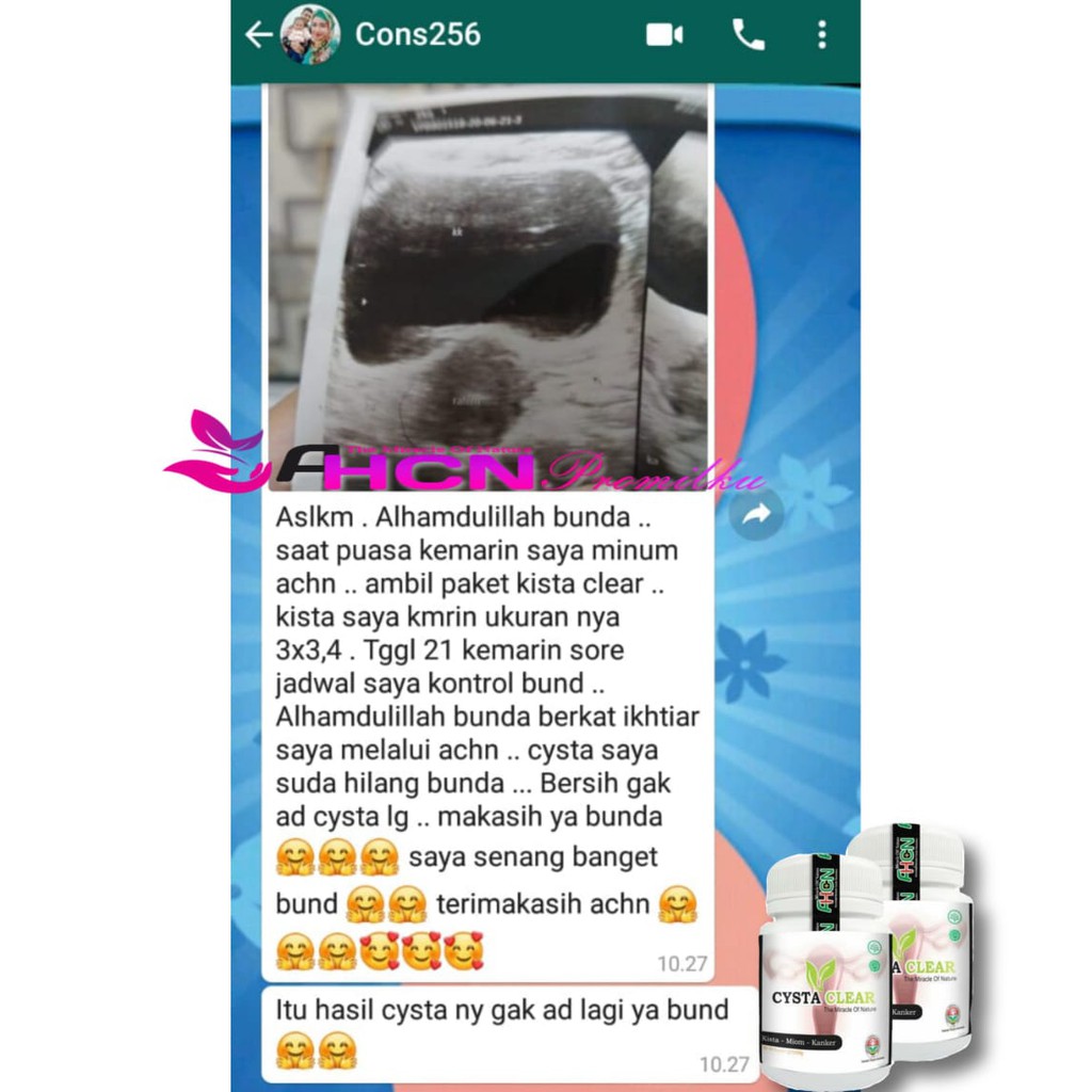 AHCN VITSUKA PLUS CYSTA CLEAR PAKET PROGRAM KEHAMILAN SEKALIGUS MENGATASI KISTA TANPA OPERASI