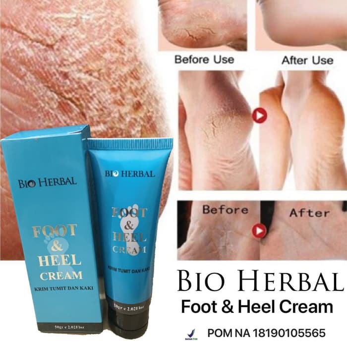 KRIM TUMIT DAN KAKI PECAH BIO HERBAL FOOT AND HEEL CREAM [BFH] ORIGINAL