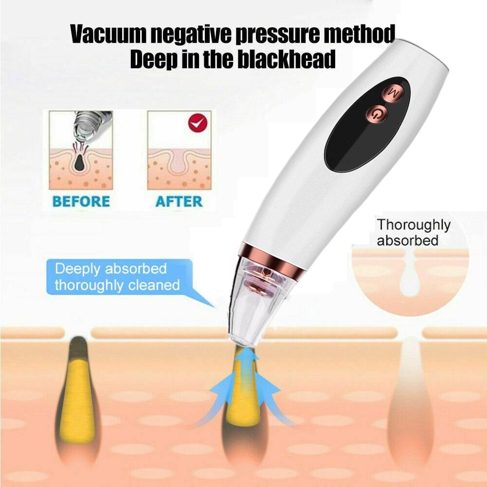 Blackhead Household Electric Blackhead Meter Pore Cleaning Tool Beauty/Blackhead Cleanser Komedo Cleaner Listrik Sedot Kulit Bersih