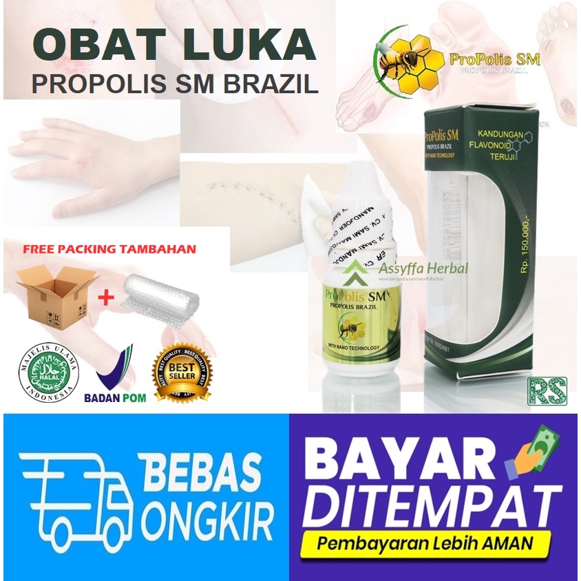 OBAT OLES PENGERING LUKA DIABETES MELITUS - PROPOLIS SM HERBAL BERKHASIAT
