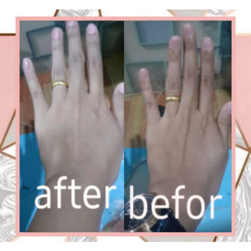 Gel Pengelupas sel kulit mati