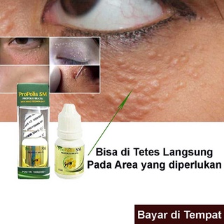 Jual Xanthelasma Oil Kode V9324 Indonesia Shopee Indonesia