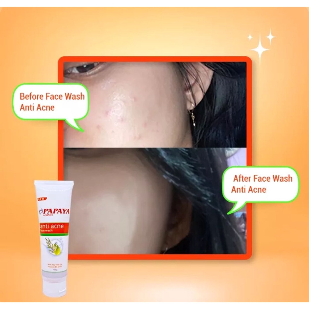 MAMAYA PAPAYA BRIGHTENING FACE WASH 100GRAM PAPAYA ANTI ACNE FACE WASH 100GRAM BPOM RESMI BERSERTIFIKASI HALAL