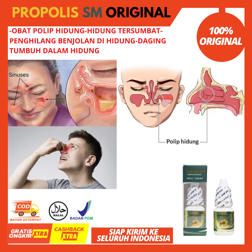 Obat Polip Hidung / Hidung Tersumbat / Penghilang Benjolan Di Hidung / Obat Sinusitis / Tumor Hidung