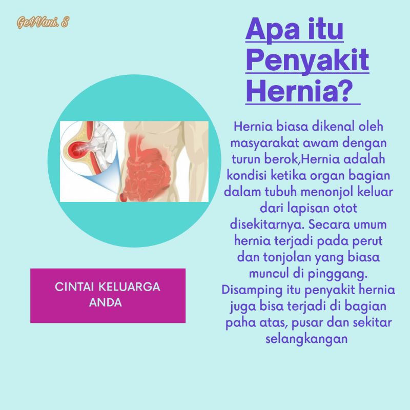 Celana Hernia Dewasa Celana Terapi Hernia Original Murah Berkualitas