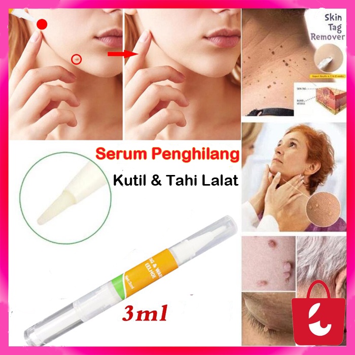 [100% Asli] Krim Obat Penghilang Kutil Badan Krim Penghilang Tanda Kulit Tahi Lalat
