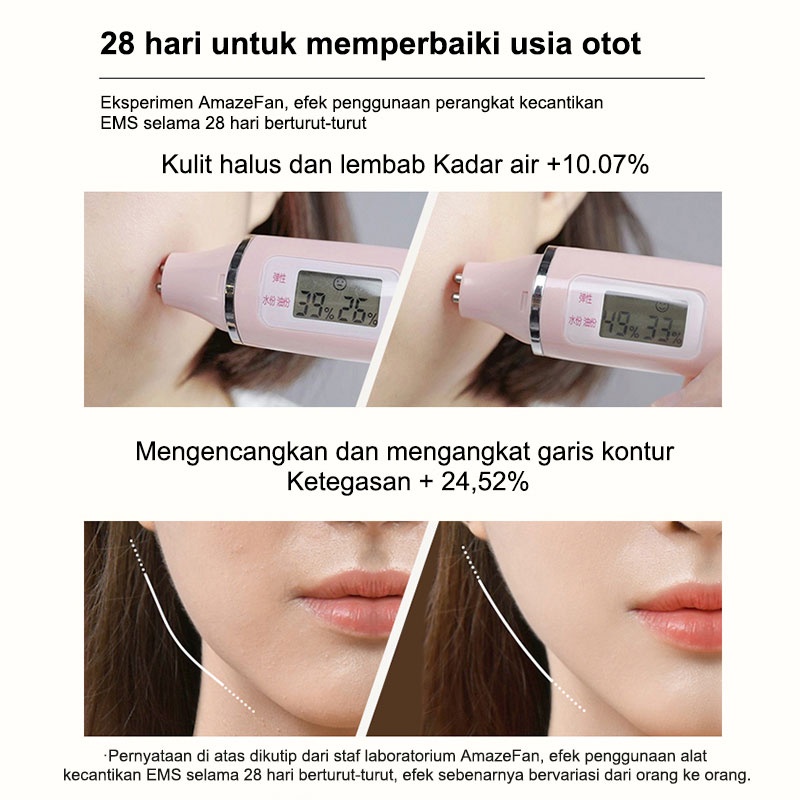 AmazeFan 4in1 setrika alat facial wajah Anti Anging alat pengecil poripori pembersih komedo wajah elektrik ion pijat face roller massager setrika kecantikan wajah RF/anti-kerut/Pemutihan/Pembersihan