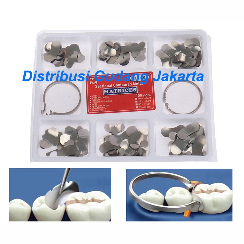 100pcs Dental matrik sectional contoured matrix metal ginjal band gigi universal