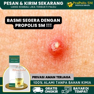 Jual Salep Obat Bisul Di Kepala Hidung Wajah Vagina Dll Pada Bayi Dewasa Alami Qnc Jelly Gamat Indonesia Shopee Indonesia