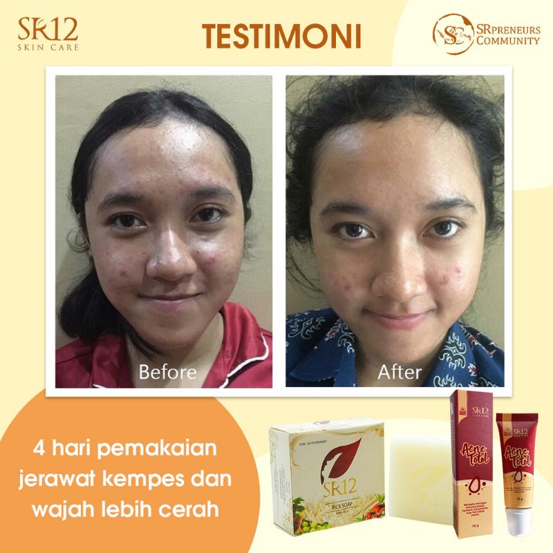 SABUN BERAS HERBAL SR12 TERLARIS..!! RICE SOAP / SABUN JERAWAT BPOM / KULIT BERMINYAK &amp; SENSITIF