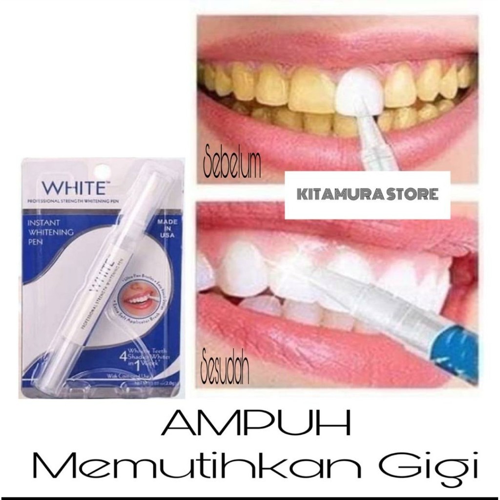 ANGKAT PLAK DENGAN CEPAT KARANG GIGI HILANG PEMUTIH GIGI PEMUTIH GIGI DAZZLING WHITENING