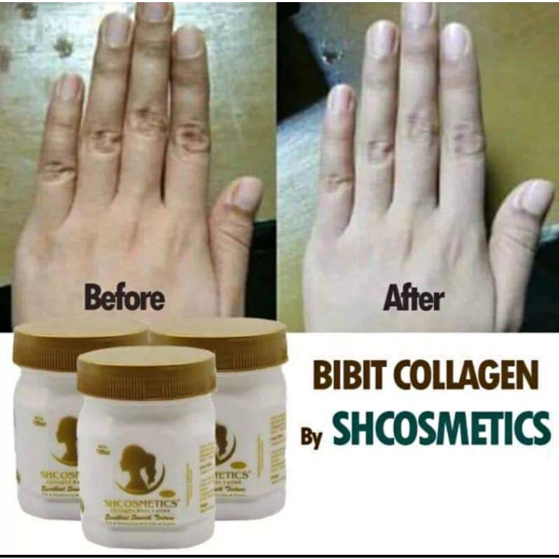 BIBIT COLLAGEN / BIBIT PEMUTIH