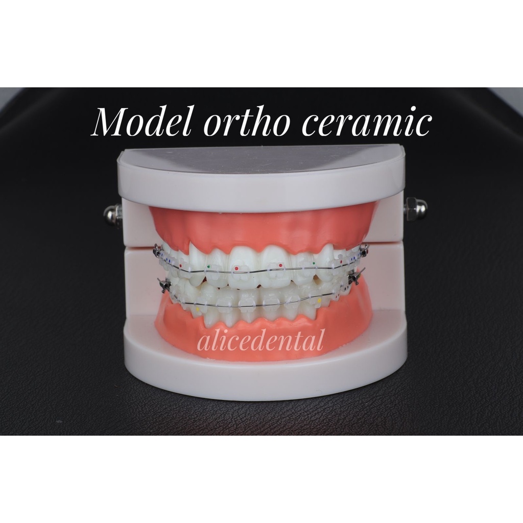 Model gigi ortho CERAMIC SAPHIRE SELF LIGATING sapphire dental study model orthodontic phantom studi