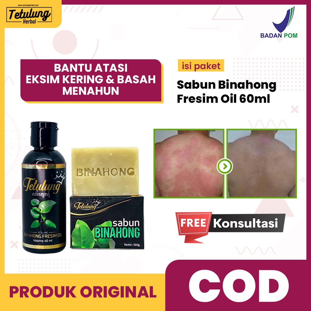 Obat Gatal Cair Kulit Eksim/Exim/Dermatitis Kering/Basah Menahun - Fresim Oil dan Sabun Binahong