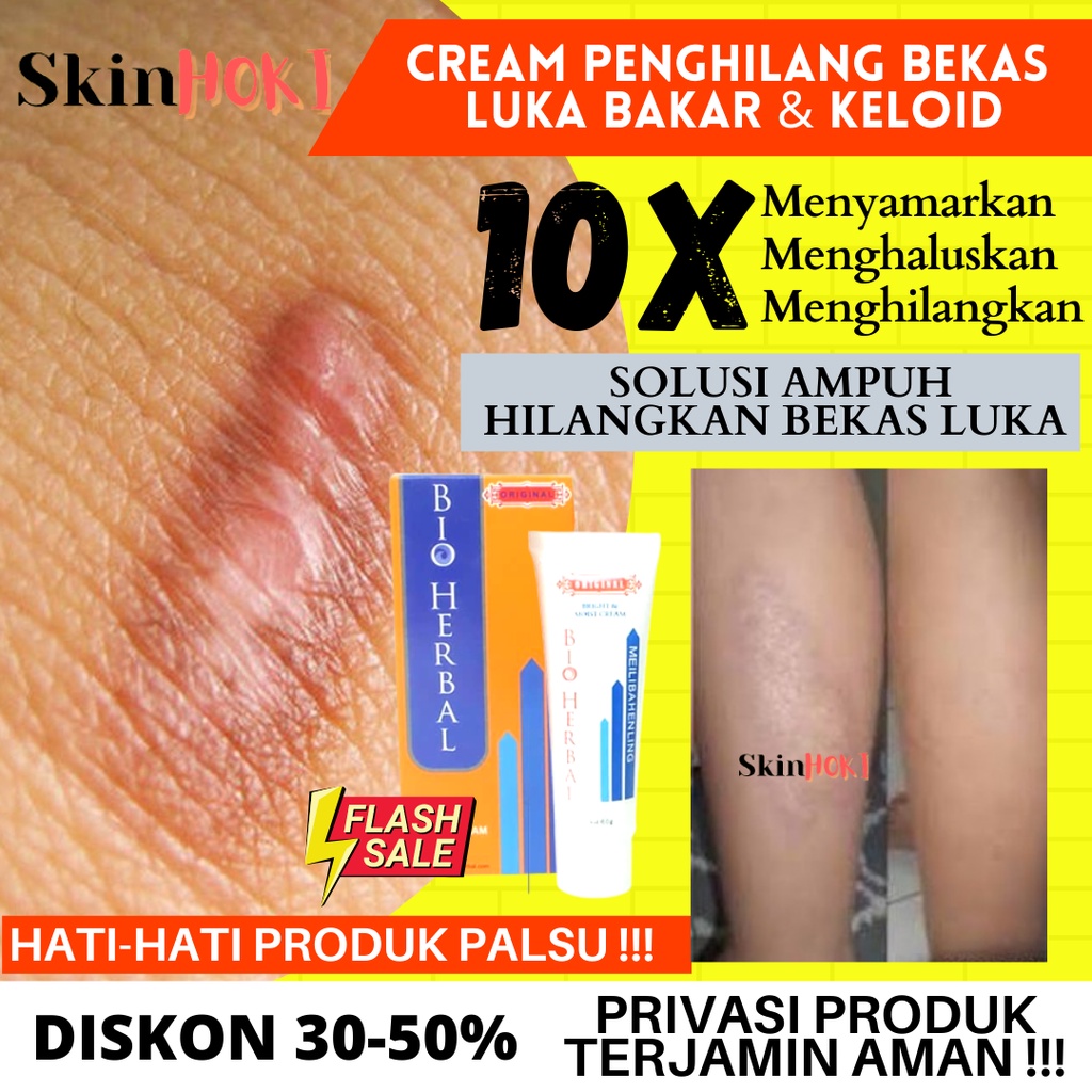 PENGHILANG BEKAS LUKA PENGHILANG KELOID BIO HERBAL MEILBAHENLING 60ML salep luka bakar PENYAMAR FLEK HITAM ORIGINAL BPOM