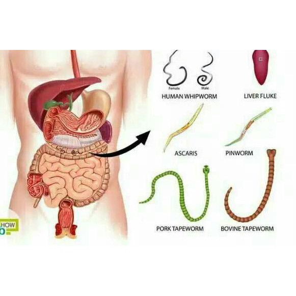 cara membunuh kuman dalam perut