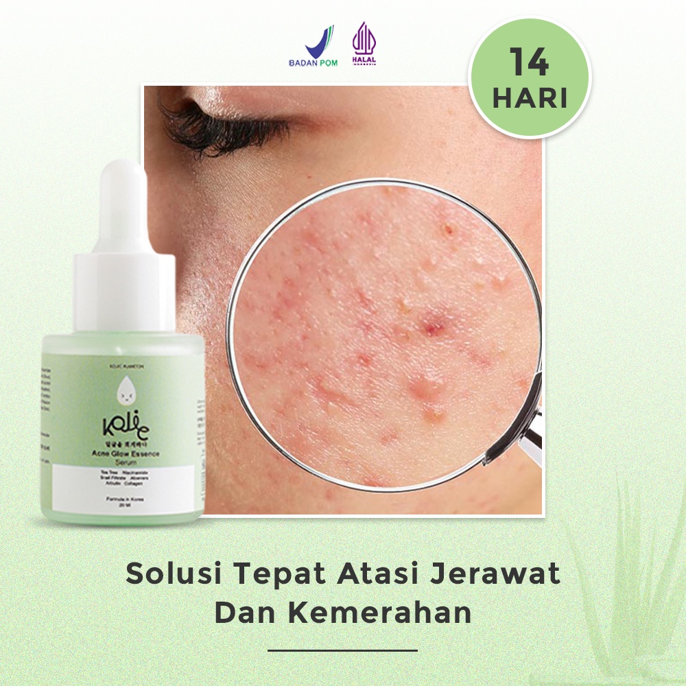 Kojic Acne Glow Essence Serum