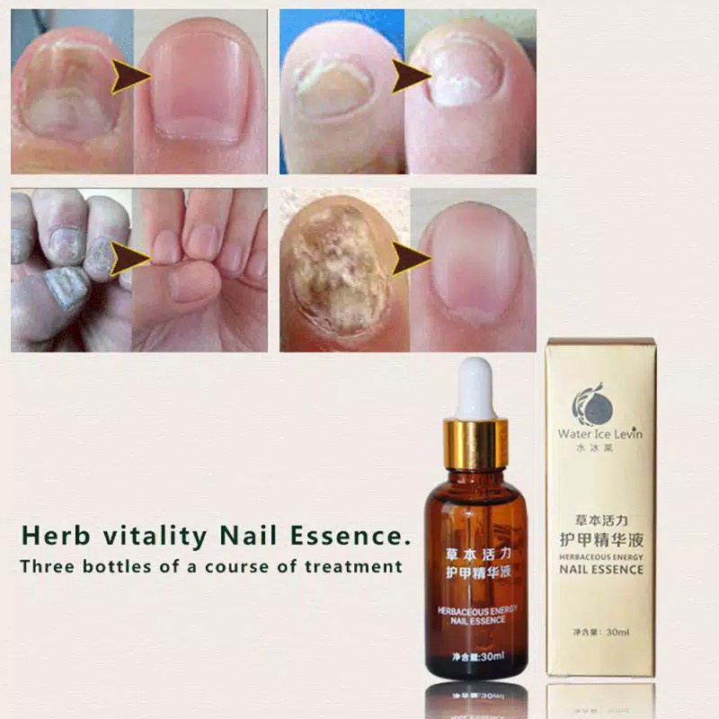 WATER ICE LEVIN Serum Kuku Nature Nail Repair Treatment Essential Oil