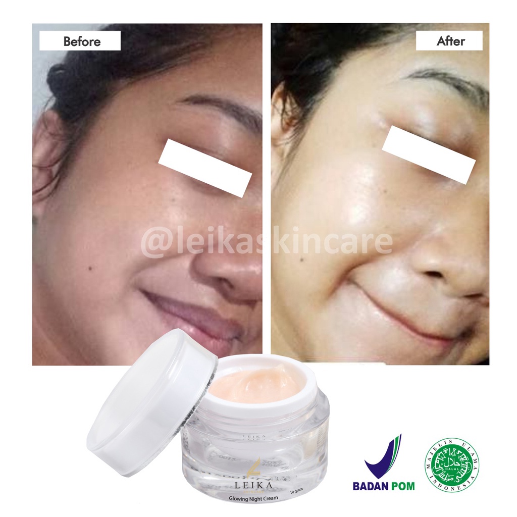 Menakjubkan! Cream Pencerah Wajah Kusam Glowing Cepat untuk Remaja BPOM Pria Wanita Asli Ampuh Krim Pemutih dan Pencerah / Perawatan wajah glowing HALAL MUI