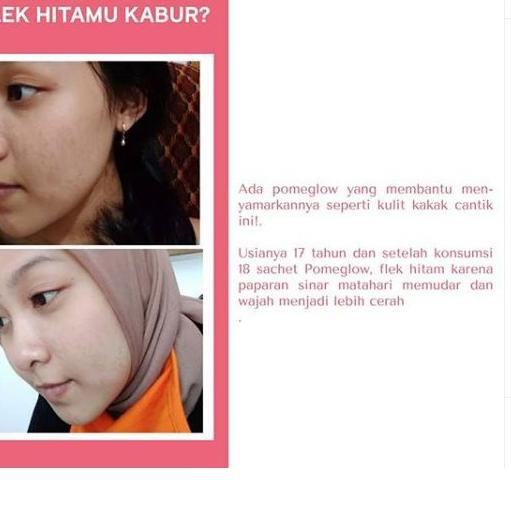 

Kirim Langsung ✱ MINUMAN KOLAGEN PEMUTIH BADAN VIRAL PERMANEN BPOM AMAN AMPUH MENGHILANGKAN JERAWAT