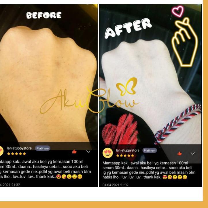 ↑ AKUGLOW WHITENING LOTION EXTRA HB KROMOSOM DOSTING KOJIC ACID PEMUTIH BADAN AMPUH TERMURAH TERLARI