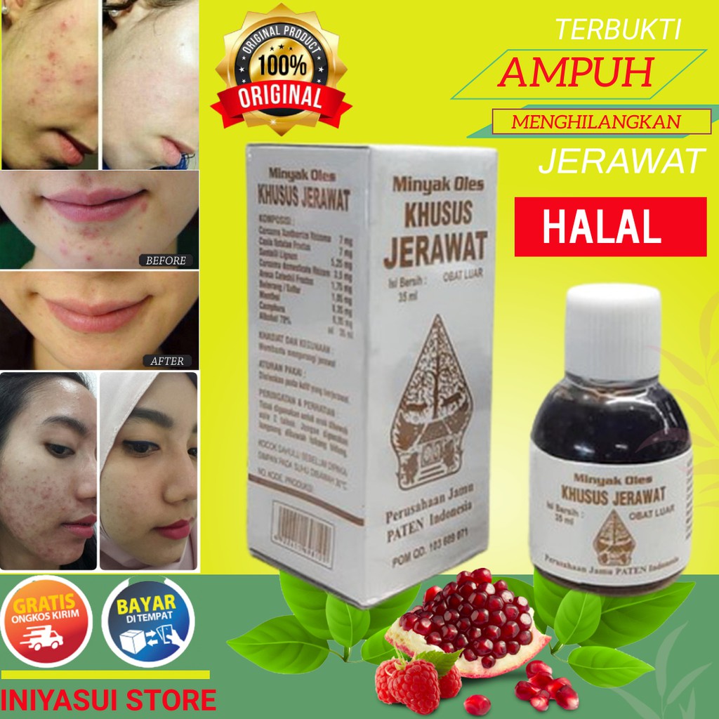 Obat Totol Jerawat Obat Jerawat Dan Bekas Jerawat Paling Ampuh Penghilang Jerawat Dan Bekas Jerawat 