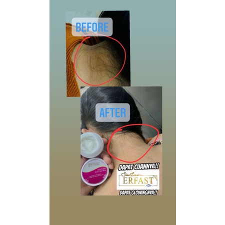 Erfast Neck Cream & Dark Skin Area