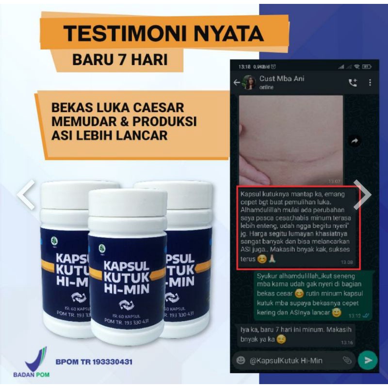 KAPSUL KUTUK HI-MIN EKSTRAK IKAN GABUS ALBUMIN OBAT PENGERING LUKA PASCA OPERASI HERBAL ALAMI (BK)