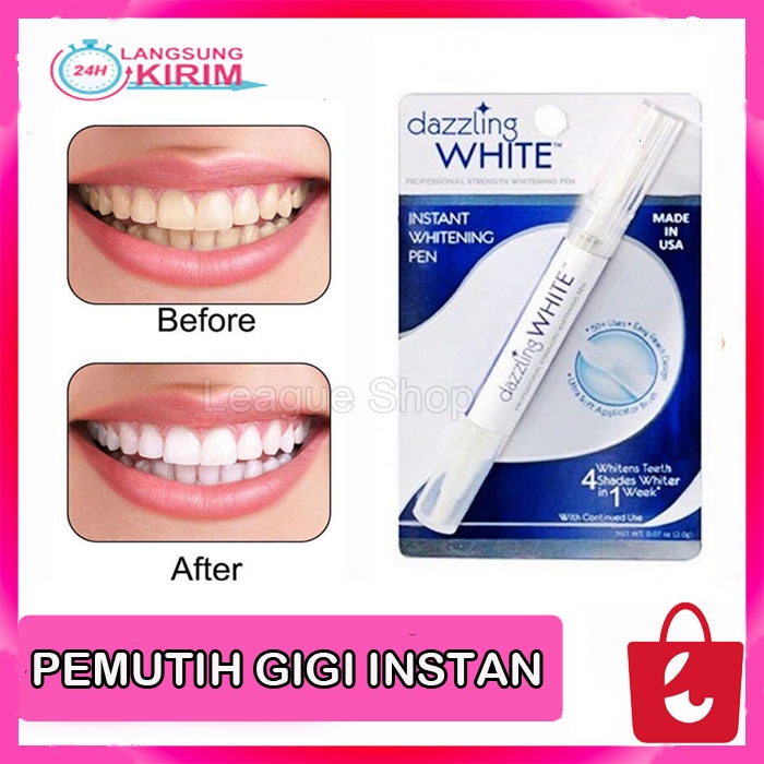 [Terbukti Alami] Dazzling White Pemutih Gigi Ampuh Instant Teeth Whitening Gel Pen Pemutih Gigi Ampuh Dan Terpecaya Memutihkan Gigi Secara Cepat Hingga Permanen - Pemutih Gigi Original