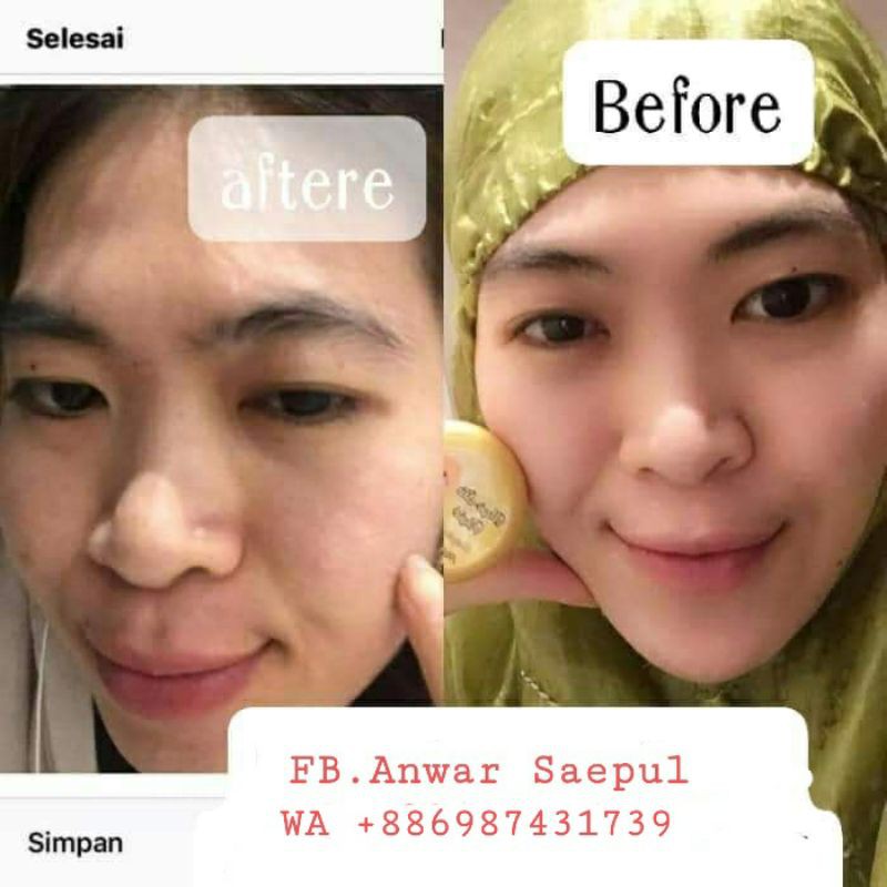 Magic skin Rhajab/cream ajaib/Rhajab skincare cream viral cream
