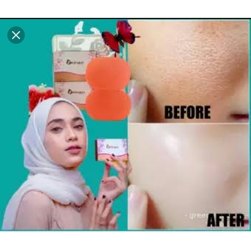 TERLARIS SABUN KLINSKIN BEAUTY/KLINSKIN BEAUTY/KLINSKIN SABUN/KLINSKIN SOAP/KLINSKIN BEAUTY SOAP ORI