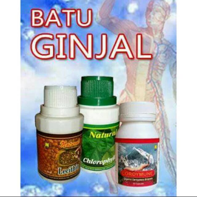 Paket pengobatan batu ginjal dari nasa