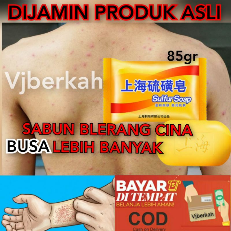 (COD)SABUN  GATAL SULFUR BLERANG  PANU KADAS KURAP SANGAT AMPUH ORIGINAL 100%