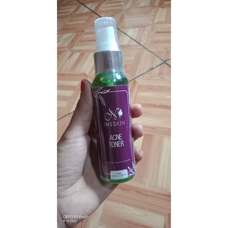 toner acne ns skincare