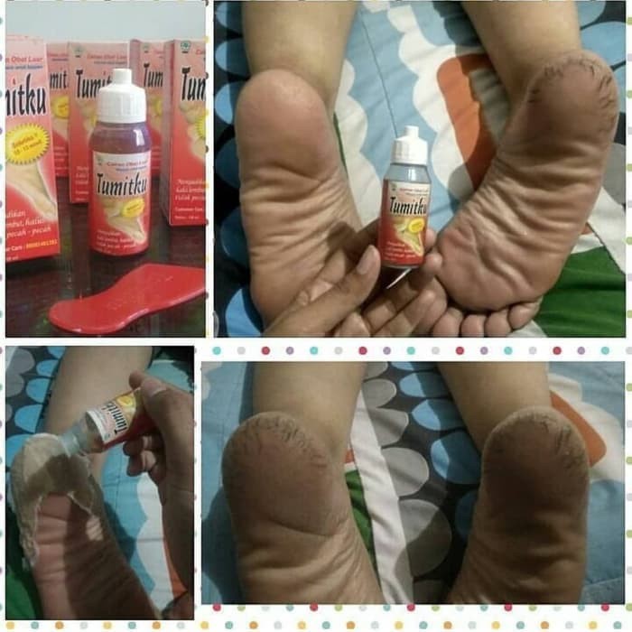 

TUMITKU 30ml kemasan 30ml JANGAN SALAH UKURAN