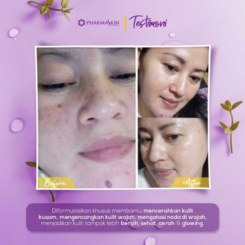 Paket  Flek Lengkap  Pharmaskin Solution-5